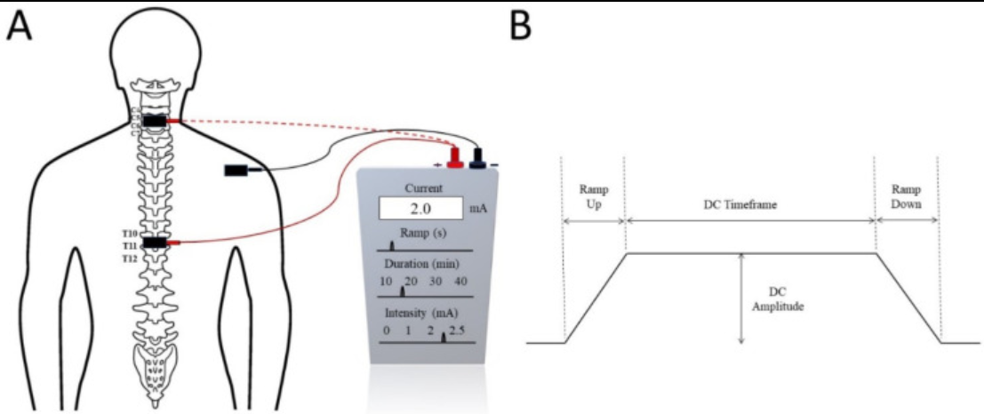 Trans_Spinal_Stimulation_Transcutaneous_Stimulation_1